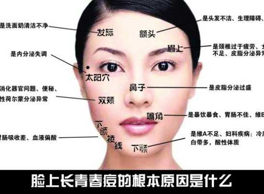 鼻子两侧长痘痘是什么原因造成的,鼻头为什么长痘痘的原因