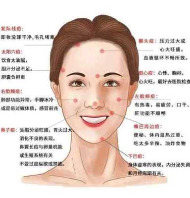 鼻子两侧长痘痘是什么原因造成的,鼻头为什么长痘痘的原因