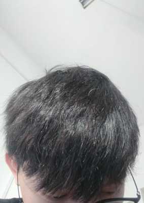 头发干枯毛燥分叉还有点硬是做柔顺好还是软化好,头发干枯适合什么发型男