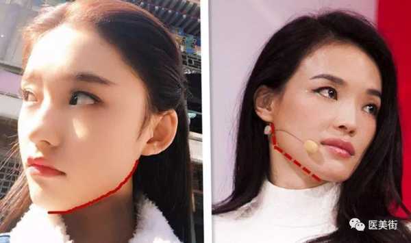 下巴翘是什么脸型（下巴翘是什么脸型图片）