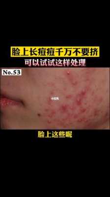 满脸起痘怎么办（脸上长痘痘怎么快速去除）