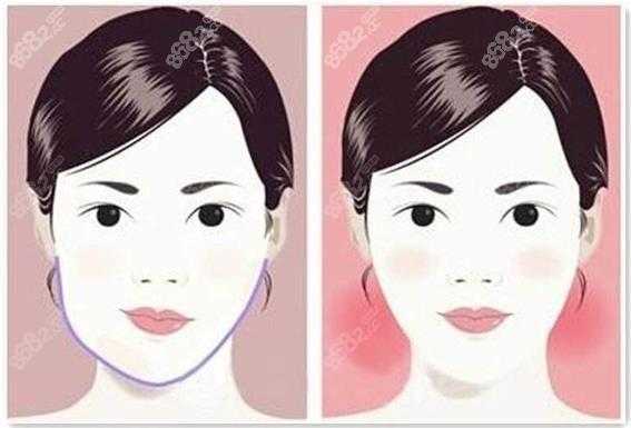 如何判断自己的脸大还是脸小,脸小怎么看出来