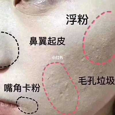 去角质和去死皮有什么区别（清洁霜和去角质的有什么区别）