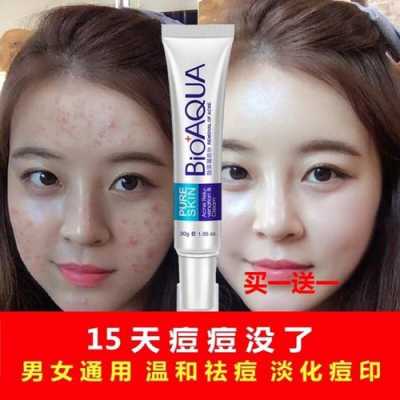 闭口涂什么,涂什么去痘痘效果最好