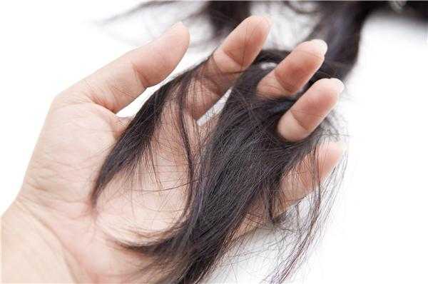 秋季头发掉的厉害怎么办（秋季头发掉的厉害怎么办女性）