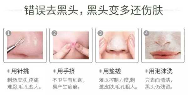 怎么取黑头（怎么取黑头以后不长）