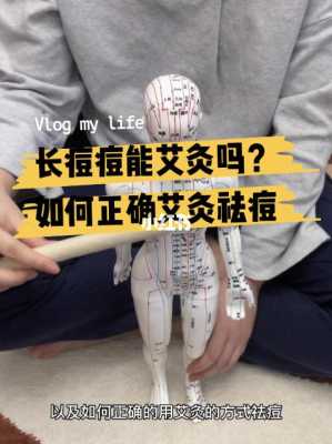 什么是痤疮,脸上起痤疮为什么不能用艾灸