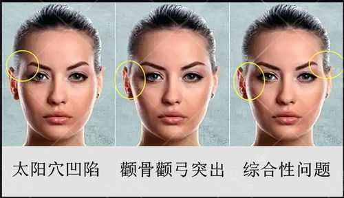 额头窄颧骨宽什么脸型（额头窄颧骨宽什么脸型好看）