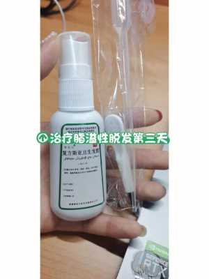 脂溢性脱发如何治疗,治疗油脂性脱发的药