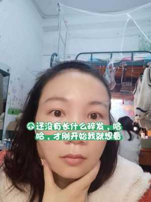 脂溢性脱发如何治疗,治疗油脂性脱发的药