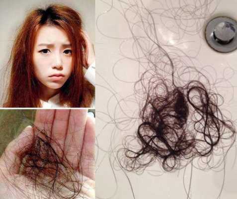烫完头发掉发正常吗,烫发后大量脱发怎么办女生