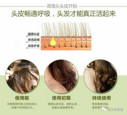 怎么滋养头发（怎么滋养头发毛囊）
