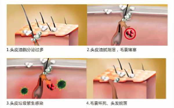 毛囊怎么样才能长新发,怎么长出新发