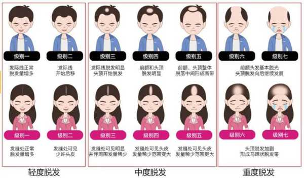 秃发是什么原因（秃顶的原因及治疗方法）