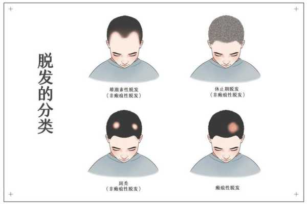 秃发是什么原因（秃顶的原因及治疗方法）