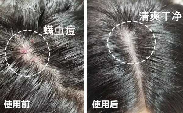 头皮油腻怎么办（头皮油腻怎么办?）