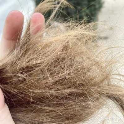 头发很干，总是会缠在一起，不知道怎么办了,头发干枯易掉怎么办女性