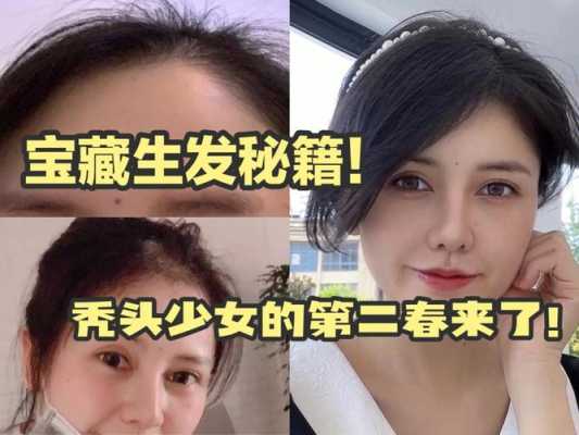 我说，怎么在十天之内让头发长长5厘米.特别是刘海部分,想要头发长得快怎么办得吃什么