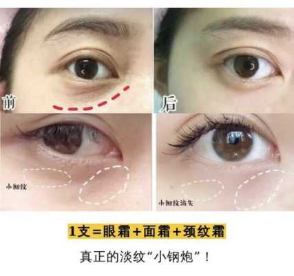 怎么去眼纹效果最好,怎么去眼纹最快最有效