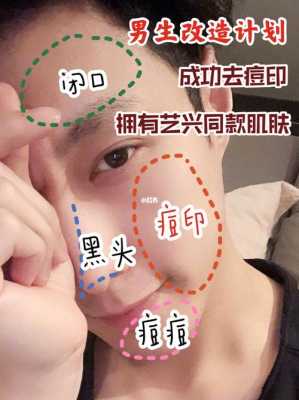男怎么去痘（男怎么去痘印）