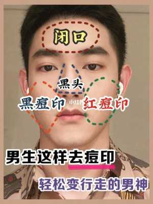 男怎么去痘（男怎么去痘印）