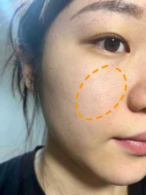 脸毛孔粗怎么办,粗毛孔怎么办小妙招