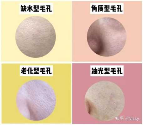 脸毛孔粗怎么办,粗毛孔怎么办小妙招
