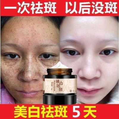 抹什么可以去斑（抹什么可以去斑点）