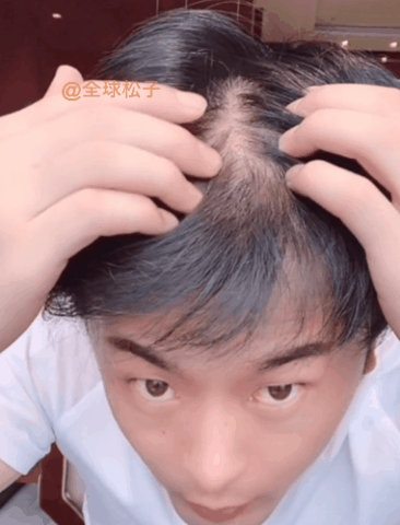 男人头发少怎么办（男人头发少怎么办）