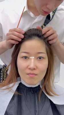 头型特别尖怎么办,额头尖怎么办才能变圆