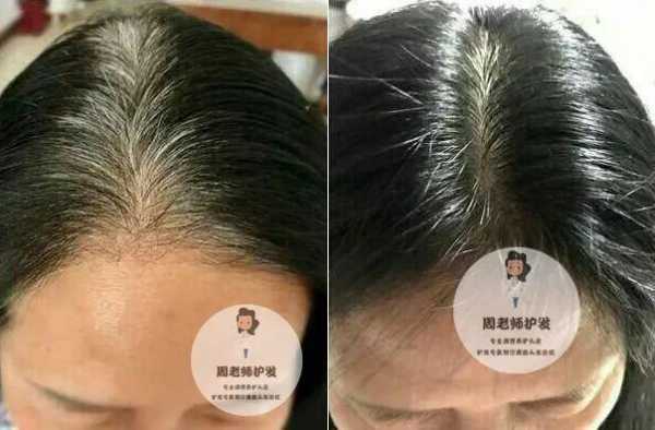 怎么冶白头发（怎么去白头发）