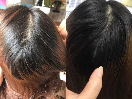 怎么冶白头发（怎么去白头发）