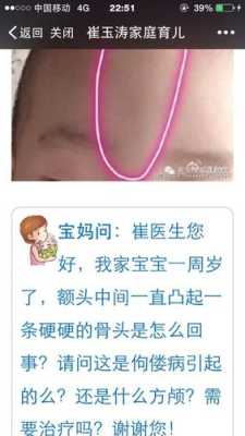 脑门凸怎么办（脑门有点凸）