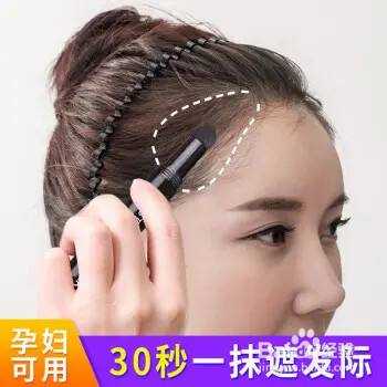鬓角头发太少怎么解决,鬓角头发少怎么办女生