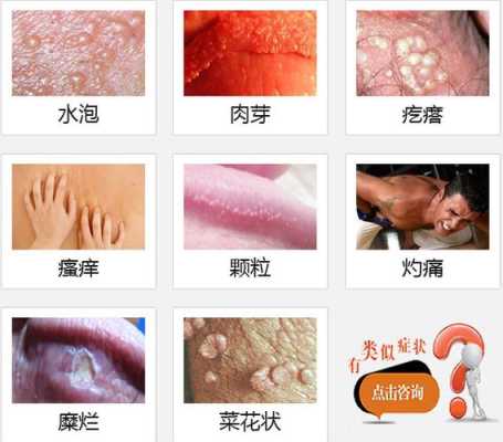 头经常痒怎么办（阴茎头老是发痒，怎么办）
