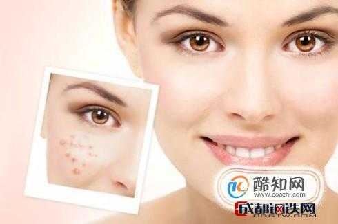 怎么才能去除脸上的痘痘（怎么才能去除脸上的痘痘和痘印）