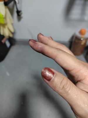 手上染了染发剂怎么洗掉（染发剂弄到手上怎么洗掉）