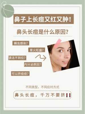 鼻子上长痘痘是怎么办（鼻子上有痘怎么去掉）