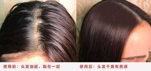 怎么去头发油（怎么去头发油腻最有效）