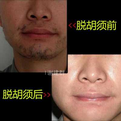 男人去胡子最好的方法,