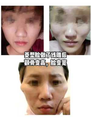 脸为什么会变大,脸怎么会变大呢