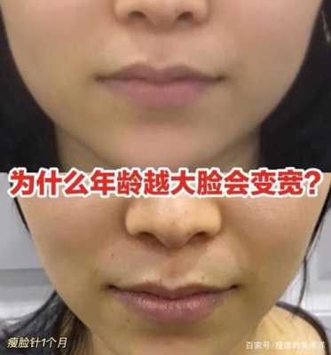 脸为什么会变大,脸怎么会变大呢