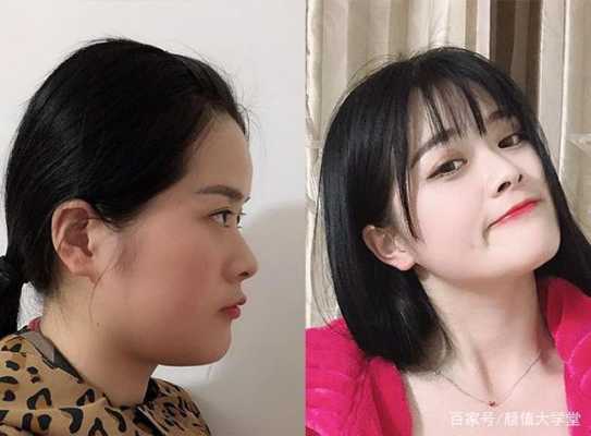 国字脸女生怎么瘦脸（国字脸瘦脸怎么办）