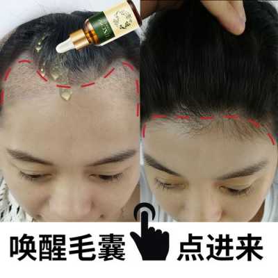 如何快速生发长发,什么可以快速生发效果好