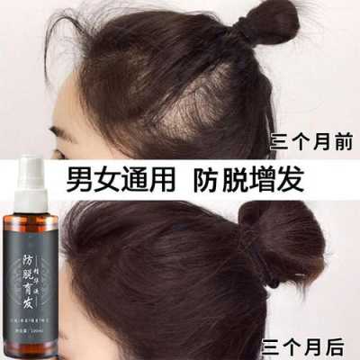 如何快速生发长发,什么可以快速生发效果好