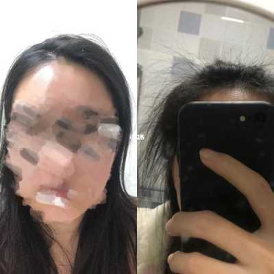 头发老是贴在额头上，怎么办，有没有办法让头发看起来蓬松点?本人男,头发软吃什么变硬