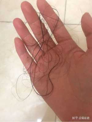 为什么自然脱落的头发是死发,为什么断头发特别多