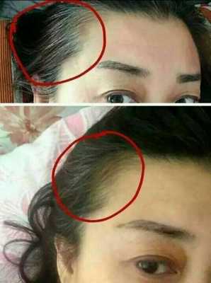 两鬓出现白发,为什么出现白发的原因