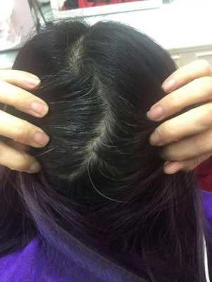 两鬓出现白发,为什么出现白发的原因