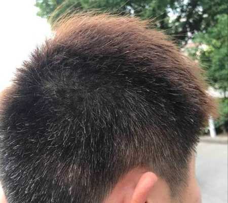 两鬓出现白发,为什么出现白发的原因